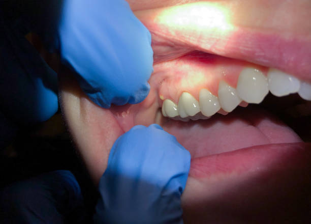 Best Emergency Treatment for Jaw Pain or Injury in Revere, MA